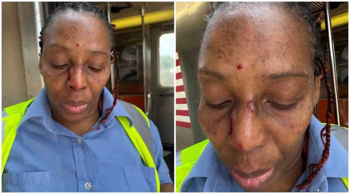 mta worker injuries side-by-side